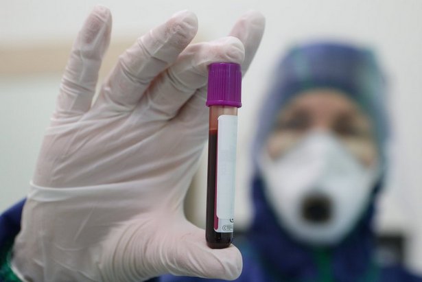 В столице провели 3 млн ПЦР-тестирований на коронавирусную инфекцию